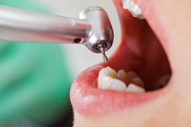 Best Emergency Broken Tooth Repair in Bowling Green, KY